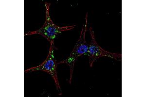 Fluorescent confocal image of HeLa cells stained with SYVN1 (HRD1) (C-term) antibody. (SYVN1 抗体  (C-Term))
