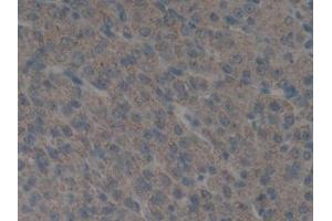 IHC-P analysis of Mouse Ovary Tissue, with DAB staining. (PLAU 抗体  (AA 180-433))