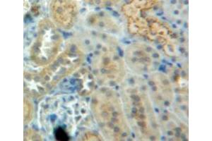 Used in DAB staining on fromalin fixed paraffin-embedded kidney tissue (CSTB 抗体  (AA 2-98))