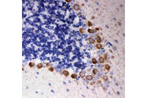 Anti- DISC1 antibody, IHC(P): Rat Cerebellum Tissue (DISC1 抗体  (Middle Region))
