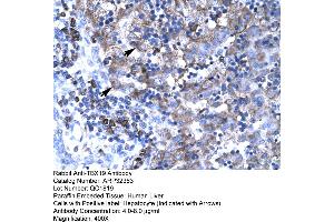 Human Liver (T-Box 19 抗体  (N-Term))