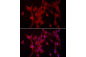Immunofluorescence (IF) image for anti-Protein tyrosine Phosphatase, Non-Receptor Type 2 (PTPN2) (AA 1-353) antibody (ABIN3022585)