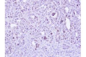 Immunohistochemistry (IHC) image for anti-Zinc Finger CCCH-Type Containing 8 (ZC3H8) antibody (ABIN2856471)