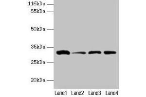 Western blot All lanes: GSTK1 antibody at 2 μg/mL Lane 1: 293T whole cell lysate Lane 2: Hela whole cell lysate Lane 3: A431 whole cell lysate Lane 4: COLO205 whole cell lysate Secondary Goat polyclonal to rabbit IgG at 1/10000 dilution Predicted band size: 26, 32, 25, 21 kDa Observed band size: 32 kDa (GSTK1 抗体  (AA 2-226))