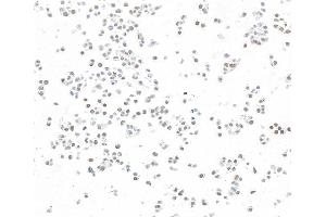 Immunocytochemistry (ICC) image for anti-Zinc Finger CCCH-Type Containing 4 (ZC3H4) (AA 1050-1100) antibody (ABIN7795761)