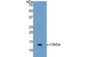 Detection of Recombinant b2M, Human using Polyclonal Antibody to Beta-2-Microglobulin (b2M) (beta-2 Microglobulin 抗体  (AA 22-119))