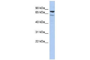 C1ORF103 antibody used at 1 ug/ml to detect target protein. (C1orf103 抗体  (Middle Region))