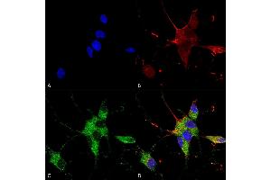 Immunocytochemistry/Immunofluorescence analysis using Mouse Anti-SHANK1/SHANK3 Monoclonal Antibody, Clone S367-51 (ABIN1741263). (SHANK3 抗体  (AA 538-626) (FITC))