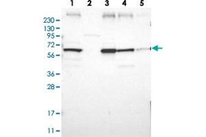 Western blot analysis of Lane 1: RT-4, Lane 2: Human Plasma, Lane 3: U-251 MG, Lane 4: Liver, Lane 5: Tonsil with CLCC1 polyclonal antibody  at 1:250-1:500 dilution. (CLCC1 抗体)