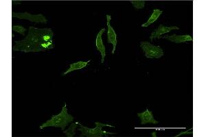 Immunofluorescence (IF) image for anti-Distal-Less Homeobox 5 (DLX5) (AA 191-279) antibody (ABIN515023)