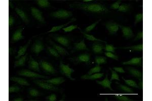Immunofluorescence of monoclonal antibody to SMAD7 on HeLa cell. (SMAD7 抗体  (AA 160-260))