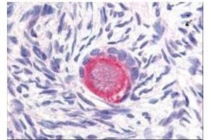 Affinity Purified anti-Delta-4 antibody was used at 20 µg/ml to detect Delta-4 in a variety of tissues including colon, liver, skeletal muscle, ovary, pancreas, prostate, testes, thymus, tonsil and uterus. (DLL4 抗体  (Internal Region))