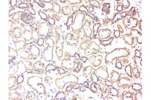 Formalin-fixed and paraffin embedded human kidney labeled with Rabbit Anti-5HT3B receptor Polyclonal Antibody, Unconjugated  at 1:200 followed by conjugation to the secondary antibody and DAB staining (Serotonin Receptor 3B 抗体  (AA 101-200))