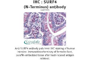 Image no. 2 for anti-Surfeit 4 (SURF4) (N-Term) antibody (ABIN1739778) (Surfeit 4 抗体  (N-Term))