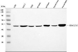 Western blot analysis of RNF216 using anti-RNF216 antibody (ABIN7601990).