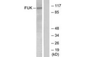 Western blot analysis of extracts from COS7 cells, treated with insulin 0. (FUK 抗体  (AA 11-60))