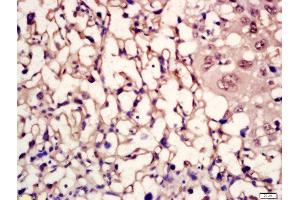 Formalin-fixed and paraffin embedded mouse placenta labeled with Rabbit Anti-MC5 Receptor/MC5-R Polyclonal Antibody, Unconjugated (ABIN1387372) at 1:200 followed by conjugation to the secondary antibody and DAB staining (MC5 Receptor 抗体  (AA 78-125))