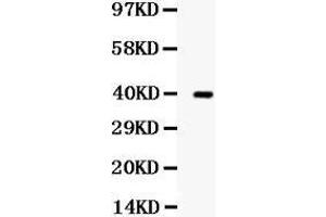 Western blot analysis of TRIB2 expression in SW620 whole cell lysates (lane 1). (TRIB2 抗体  (Middle Region))