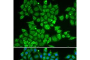 Immunofluorescence analysis of U2OS cells using PDE1B Polyclonal Antibody (PDE1B 抗体)