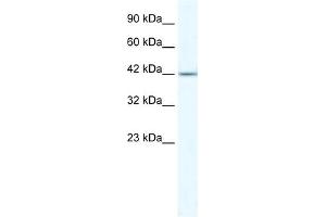 WB Suggested Anti-ZNF70 Antibody Titration:  5. (ZNF70 抗体  (N-Term))