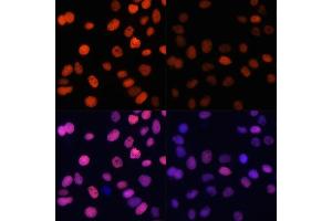 Immunofluorescence analysis of HeLa cells using Acetyl-Histone H4-K91 antibody (ABIN7267748) at dilution of 1:100.