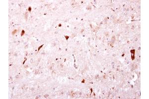 IHC-P Image BTD antibody [N3C3] detects BTD protein at cytosol on mouse hind brain by immunohistochemical analysis. (BTD 抗体)