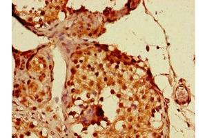 Immunohistochemistry of paraffin-embedded human testis tissue using ABIN7144480 at dilution of 1:100 (PPP1R13B 抗体  (AA 375-675))