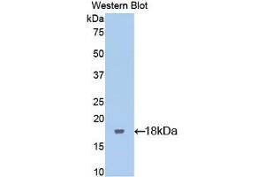 Western blot analysis of the recombinant protein. (LIFR 抗体  (AA 151-290))