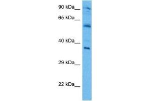 Host:  Mouse  Target Name:  IRF1  Sample Tissue:  Mouse Brain  Antibody Dilution:  1ug/ml (IRF1 抗体  (Middle Region))