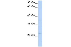 TNFRSF18 antibody (20R-1290) used at 0. (TNFRSF18 抗体  (C-Term))