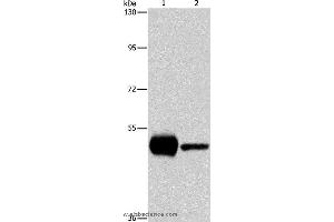 Western blot analysis of K562 and mouse brain tissue, using PIP4K2A Polyclonal Antibody at dilution of 1:1150 (PIP4K2A 抗体)
