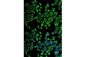 Immunofluorescence analysis of HeLa cell using HSPD1 antibody. (HSPD1 抗体  (AA 27-240))