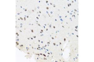 Immunohistochemistry of paraffin-embedded rat brain using PRPF8 antibody. (PRPF8 抗体  (AA 1-100))