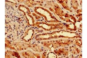 Immunohistochemistry of paraffin-embedded human kidney tissue using ABIN7173369 at dilution of 1:100 (Slc25a1 抗体  (AA 144-182))