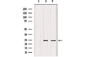 Western blot analysis of extracts from various samples, using RAB6A Antibody. (RAB6A 抗体  (Internal Region))