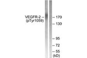 Western blot analysis of extracts from HepG2 cells treated with Na3VO4 0. (VEGFR2/CD309 抗体  (pTyr1059))