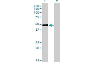 Western Blot analysis of CRLF1 expression in transfected 293T cell line by CRLF1 monoclonal antibody (M01), clone 4F4.