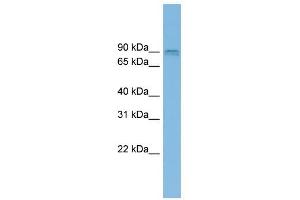 CENTG1 antibody used at 1 ug/ml to detect target protein. (AGAP2 抗体  (Middle Region))