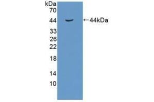 Detection of Recombinant RB1, Human using Polyclonal Antibody to Retinoblastoma Protein 1 (RB1) (Retinoblastoma 1 抗体  (AA 639-778))