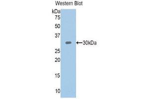 Western Blotting (WB) image for anti-Plastin 3 (PLS3) (AA 379-630) antibody (ABIN1111126) (Plastin 3 抗体  (AA 379-630))