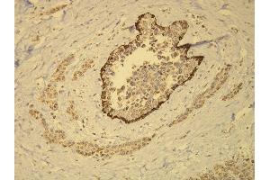 Immunohistochemistry (IHC) image for anti-Keratin 14 (KRT14) (AA 455-471), (C-Term) antibody (ABIN870552) (KRT14 抗体  (C-Term))