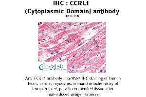 Image no. 1 for anti-Chemokine (C-C Motif) Receptor-Like 1 (CCRL1) (1st Cytoplasmic Domain) antibody (ABIN1732790) (CCRL1 抗体  (1st Cytoplasmic Domain))