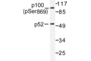 Image no. 1 for anti-Nuclear Factor of kappa Light Polypeptide Gene Enhancer in B-Cells 2 (NFKB2) (pSer869) antibody (ABIN318077) (NFKB2 抗体  (pSer869))