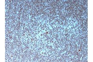 Image no. 3 for anti-Nucleolar / Nucleoli antibody (ABIN6153718) (Nucleolar / Nucleoli 抗体)