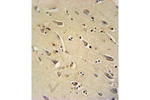 TC10 Antibody (Center) (ABIN652036 and ABIN2840510) immunohistochemistry analysis in formalin fixed and paraffin embedded human brain tissue followed by peroxidase conjugation of the secondary antibody and DAB staining. (RHOQ 抗体  (AA 48-76))