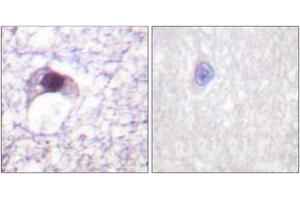Immunohistochemistry (IHC) image for anti-E2F Transcription Factor 6 (E2F6) (AA 141-190) antibody (ABIN1533260)