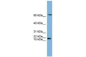 GM2A antibody used at 1 ug/ml to detect target protein. (GM2A 抗体  (N-Term))