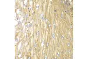 Immunohistochemistry of paraffin-embedded human esophagus using PPP2R2A antibody (ABIN5971211) at dilution of 1/100 (40x lens). (PPP2R2A 抗体)