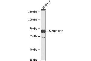 Western blot analysis of extracts of SH-SY5Y cells, using M antibody (ABIN6133958, ABIN6143567, ABIN6143569 and ABIN6224825) at 1:1000 dilution. (Tricellulin 抗体  (AA 200-300))