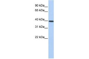 WB Suggested Anti-TIA1 Antibody Titration:  0. (TIA1 抗体  (N-Term))
